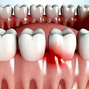 발치 후 냄새 문제를 정확히 이해하고 해결하세요